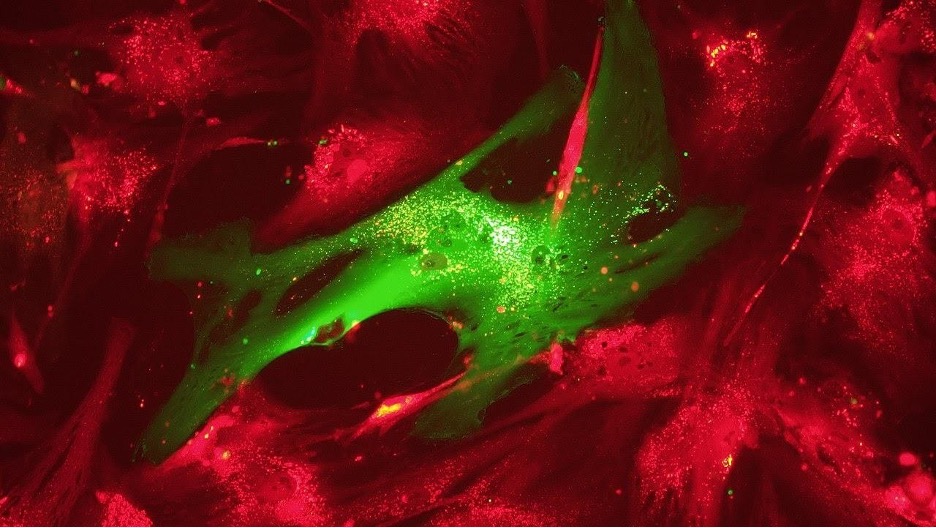 The process of intussusceptive angiogenesis, in which blood vessels are being prepared and produced. Unfortunately, the coronavirus produces severe blood clots in these blood vessels preventing this repairing process of angiogenesis from occurring.