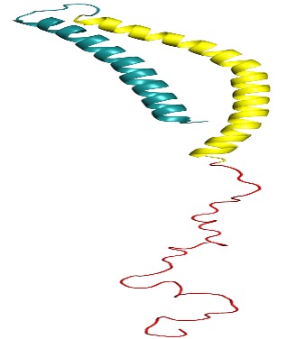 A New Method to Track Parkinson’s Disease