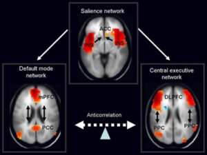 The importance of the Default Mode Network (DMN) in Post-Traumatic Stress Disorder (PTSD)