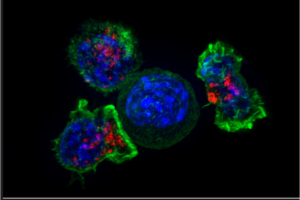 Defective Mitochondria Lead to Exhausted T Cells in the Tumor Microenvironment