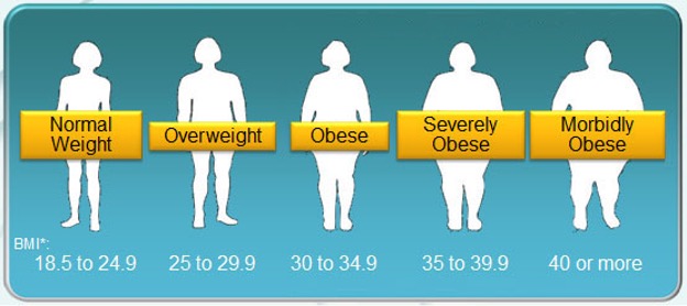 Factors in the Onset of Obesity – An American Public Health Crisis