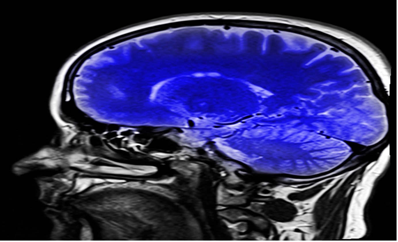 An Overview of Modern BrainImaging Techniques ICJS International