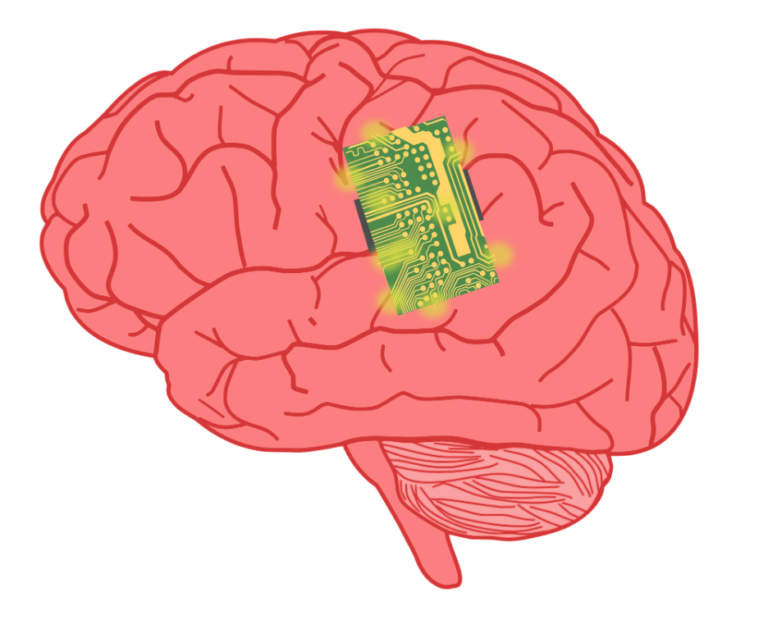 Brain Computer Interfaces: Approaches to Scientific Innovation - ICJS ...